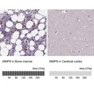 Anti-MMP9 antibody produced in rabbit 