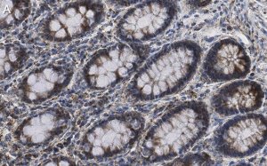 Anti-Mn-SOD Antibody, clone 1C14 ZooMAb Rabbit Monoclonal 