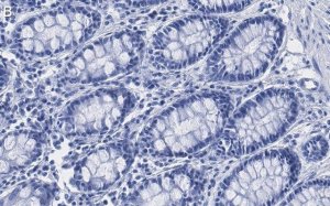 Anti-Mn-SOD Antibody, clone 1C14 ZooMAb Rabbit Monoclonal 