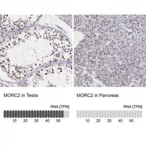 Anti-MORC2 antibody produced in rabbit 