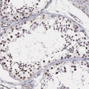Anti-MORC2 antibody produced in rabbit 