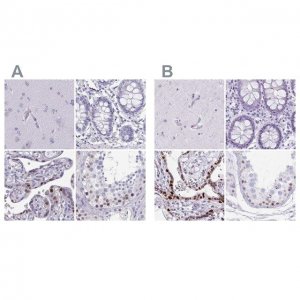 Anti-MORC4 antibody produced in rabbit 