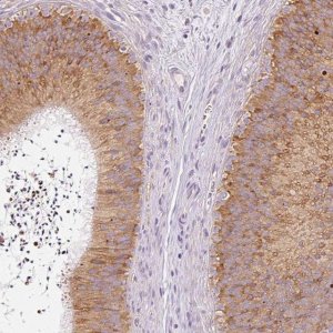 Anti-MORN4 antibody produced in rabbit 