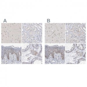 Anti-MPHOSPH10 antibody produced in rabbit 