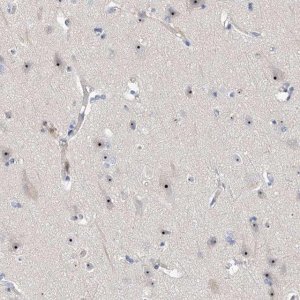 Anti-MPHOSPH10 antibody produced in rabbit 