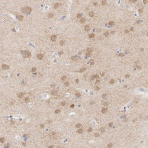 Anti-MPP2 antibody produced in rabbit 