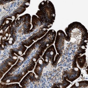 Anti-MPP3 antibody produced in rabbit HPA021818-100UL