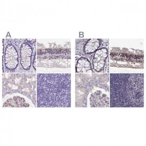 Anti-MPP5 antibody produced in rabbit 