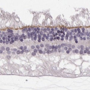 Anti-MPP5 antibody produced in rabbit 