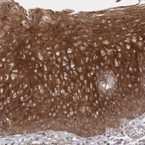 Anti-MPP7 antibody produced in rabbit 