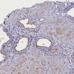 Anti-MPV17L2 antibody produced in rabbit HPA043111-100UL