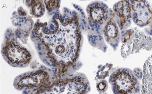 Anti-MR-proADM Antibody, clone 2B19 ZooMAb Rabbit Monoclonal 