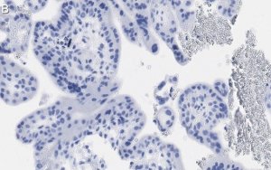 Anti-MR-proADM Antibody, clone 2B19 ZooMAb Rabbit Monoclonal 