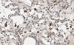 Anti-MRC1 Antibody, clone 1C9 ZooMAb Rabbit Monoclonal 