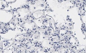 Anti-MRC1 Antibody, clone 1C9 ZooMAb Rabbit Monoclonal 