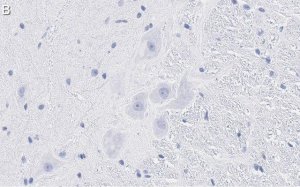 Anti-MRGPRX4 Antibody, clone 3F4 ZooMAb Rabbit Monoclonal 