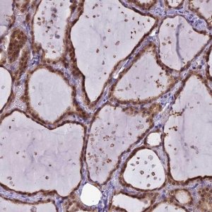 Anti-MRI1 antibody produced in rabbit 