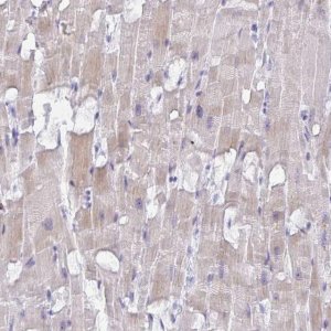 Anti-MRM2 antibody produced in rabbit 