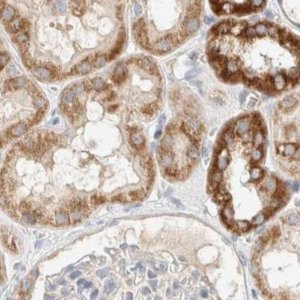 Anti-MRM3 antibody produced in rabbit 
