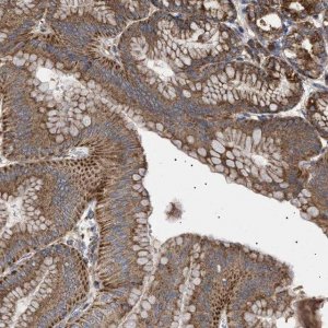 Anti-MRPL10 antibody produced in rabbit 