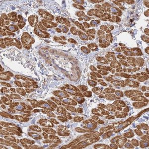 Anti-MRPL15 antibody produced in rabbit 