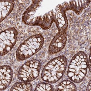 Anti-MRPL20 antibody produced in rabbit 