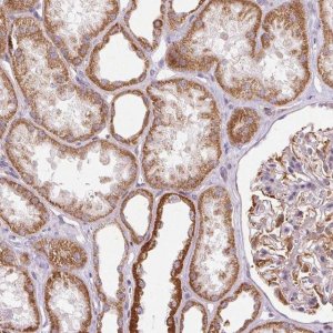 Anti-MRPL24 antibody produced in rabbit HPA054323-100UL