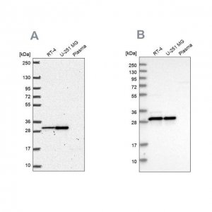Anti-MRPL28 antibody produced in rabbit 