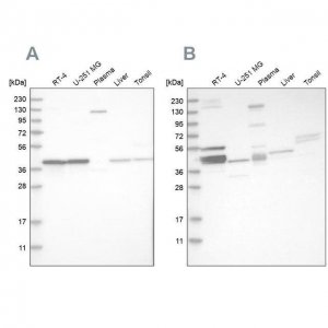 Anti-MRPL38 antibody produced in rabbit 