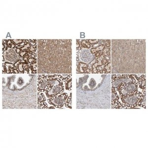 Anti-MRPL45 antibody produced in rabbit 
