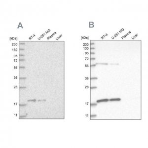 Anti-MRPS10 antibody produced in rabbit HPA029133-100UL