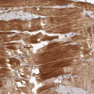 Anti-MRPS10 antibody produced in rabbit HPA029133-100UL