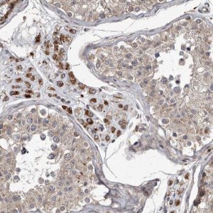 Anti-MRPS15 antibody produced in rabbit 