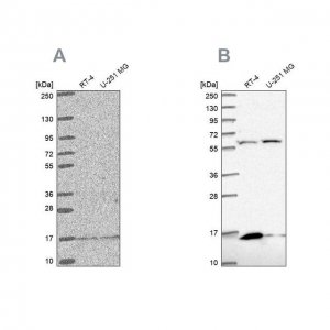 Anti-MRPS16 antibody produced in rabbit 