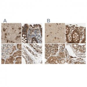 Anti-MRPS22 antibody produced in rabbit 