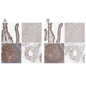 Anti-MSH6 antibody produced in rabbit 