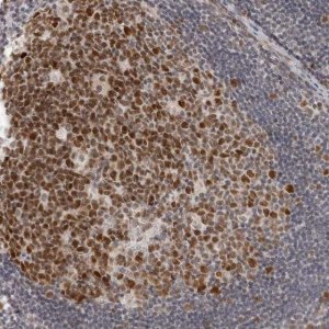 Anti-MSH6 antibody produced in rabbit 