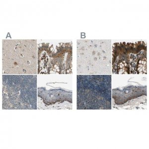 Anti-MST1R antibody produced in rabbit 