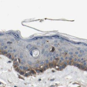 Anti-MST1R antibody produced in rabbit 