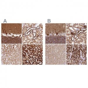 Anti-MT-CO2 antibody produced in rabbit HPA051505-100UL
