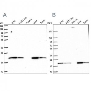 Anti-MT-CO2 antibody produced in rabbit HPA051505-100UL