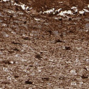 Anti-MT3 antibody produced in rabbit 