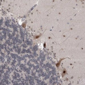 Anti-MTBP antibody produced in rabbit 