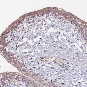 Anti-MTERF1 antibody produced in rabbit HPA044894-100UL