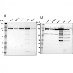 Anti-MTHFD1 antibody produced in rabbit 