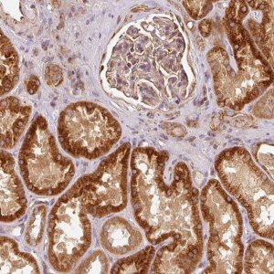 Anti-MTHFD1L antibody produced in rabbit 