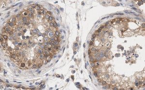 Anti-mTOR Antibody, clone 4O5 ZooMAb Rabbit Monoclonal 