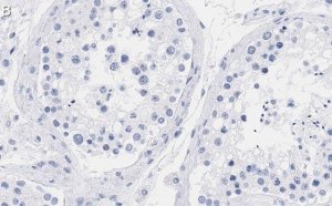 Anti-mTOR Antibody, clone 4O5 ZooMAb Rabbit Monoclonal 