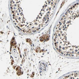 Anti-MTX1 antibody produced in rabbit HPA011543-100UL