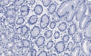 Anti-MUC1 Antibody, clone 1F23 ZooMAb Rabbit Monoclonal 